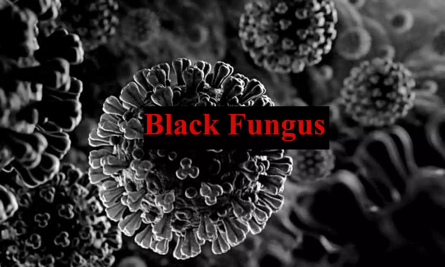 Black fungus in sultanpur