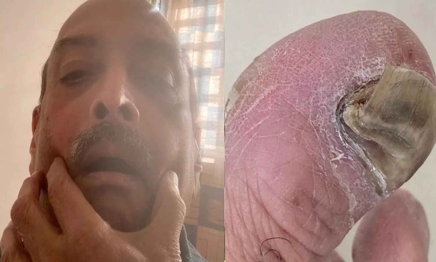 Mehul Choksi has been beaten up in Dominica and electrocuted.
