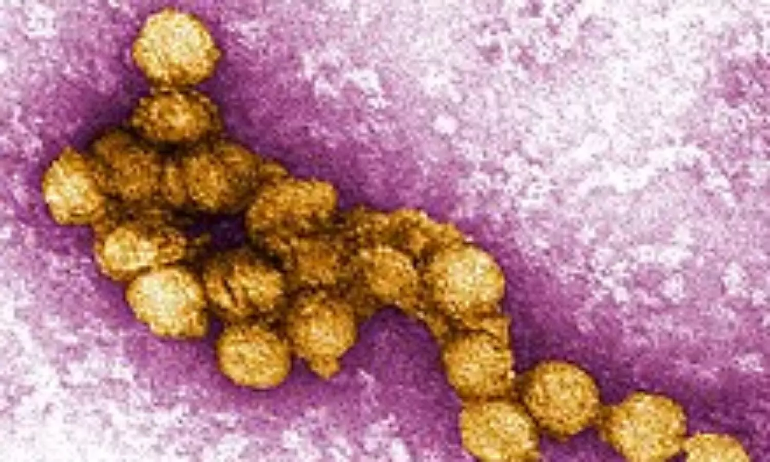 West Nile virus in California news