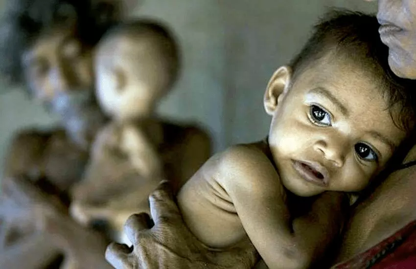 UP-Bihar backward in childrens nutrition