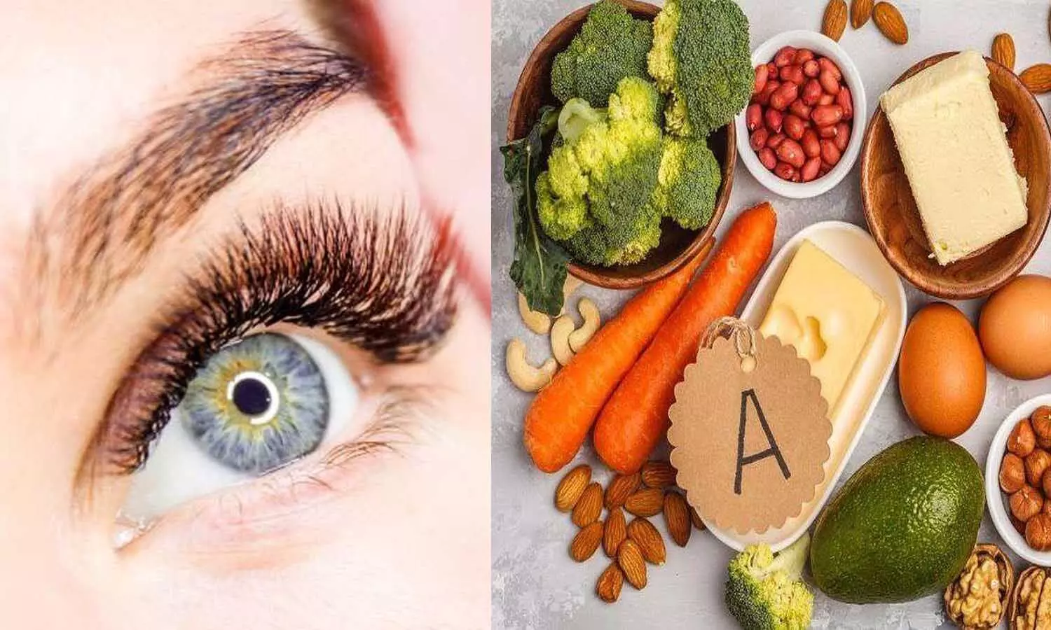 Aankhon Ke Liye Vitamin: आंखों की समस्या को दूर रखते हैं ये विटामिन, खाने में जरूर शामिल करें ये चीजें