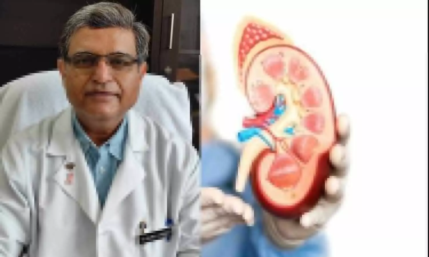 SGPGI Chief Medical Superintendent Professor Gaurav Agrawal