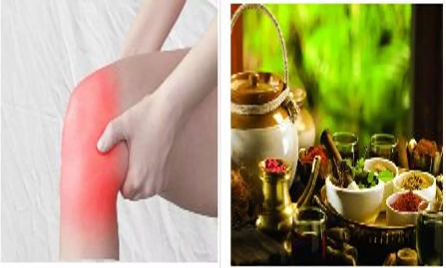 Successful Treatment Knee From Ayurveda Panchakarma Medicine Therapy Dr. Devesh Kumar Srivastava Health News