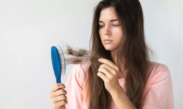 Hair Fall Tips: सर्दियों में टूट रहे हैं बाल, तो ऐसे रखे अपने बालों का ध्यान