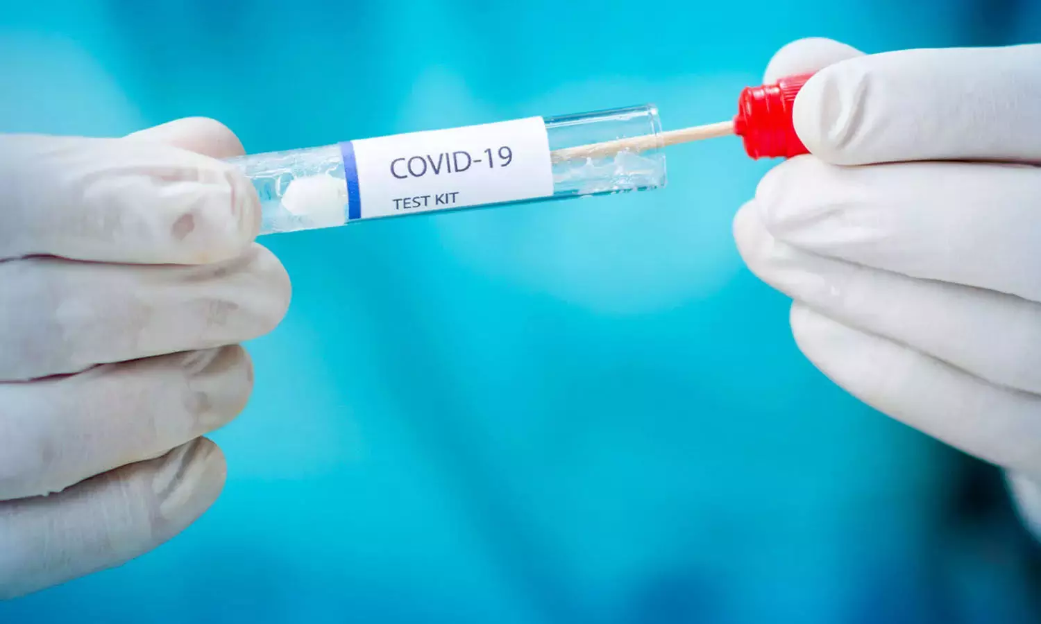 Coronavirus: देश में कोरोना विस्फोट, बीते 24 घंटे में मिले 5,326 नए केस, ओमिक्रॉन ने बढ़ाई चिंता