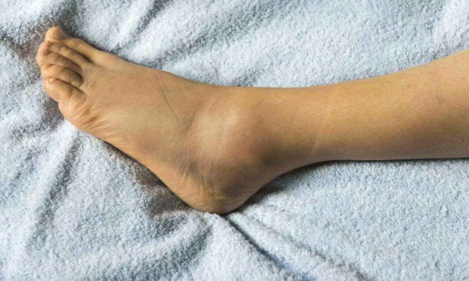 Feet Swelling: पैरों की सूजन कई गंभीर बीमारियों के हो सकते हैं लक्षण, बिल्कुल भी न करें इग्नोर