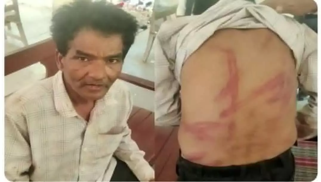 Pratapgarh News Tehsil employee dies due to SDM beating