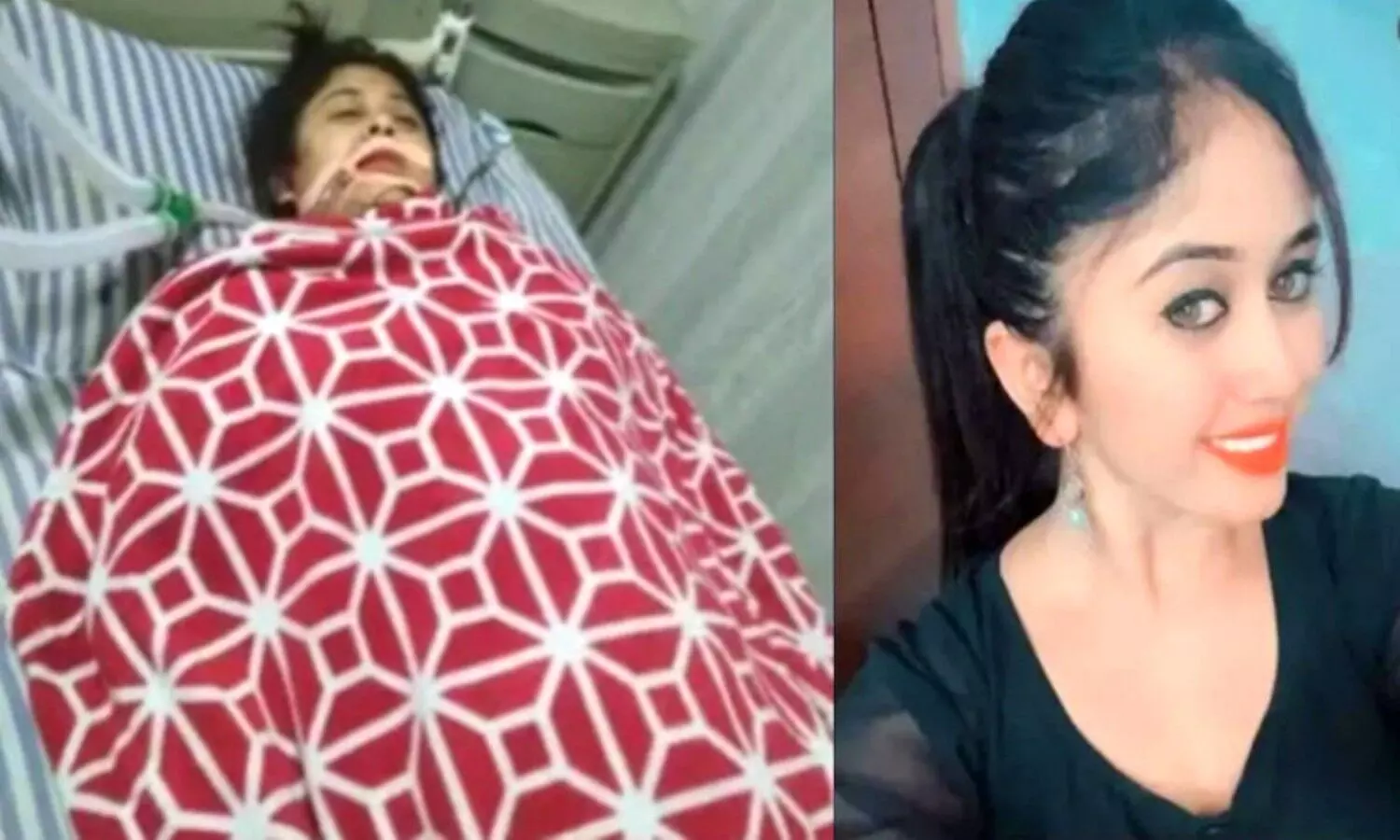 Plastic Surgery Chethana Raj Death
