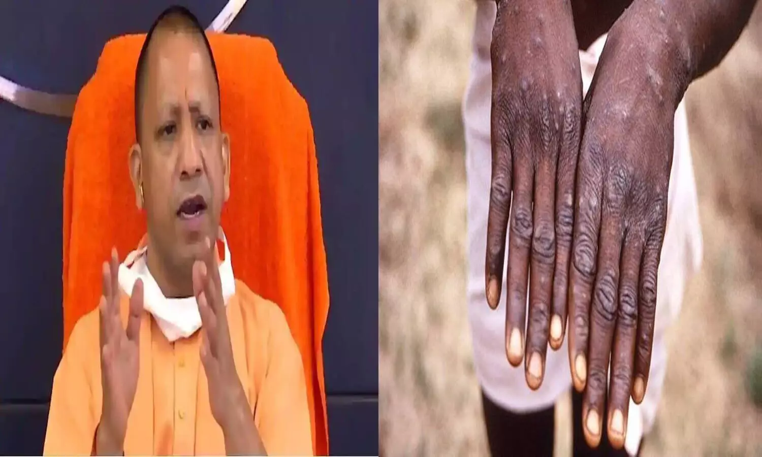 cm yogi warned about Monkeypox