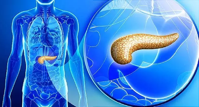 the problem of diabetes can give rise to cancer of the pancreas