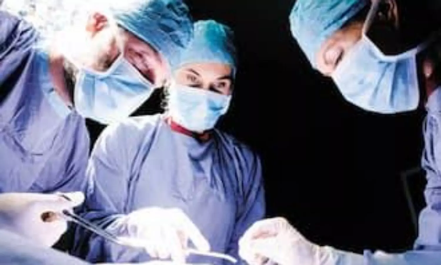 First Gender Reassignment Surgery in meerut