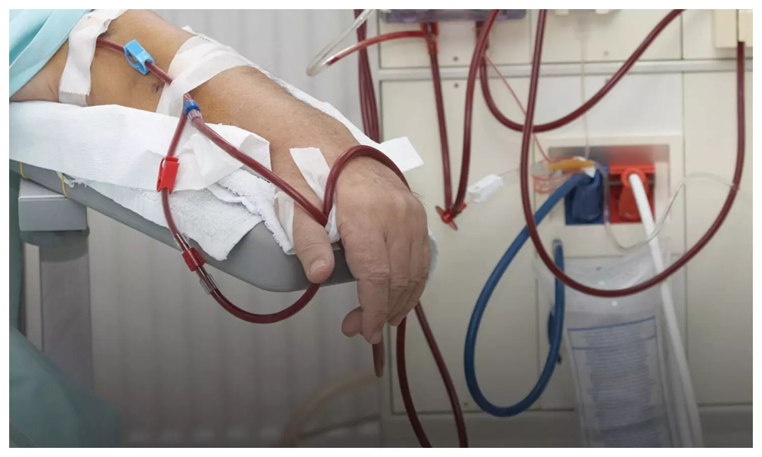 Dialysis and Cancer
