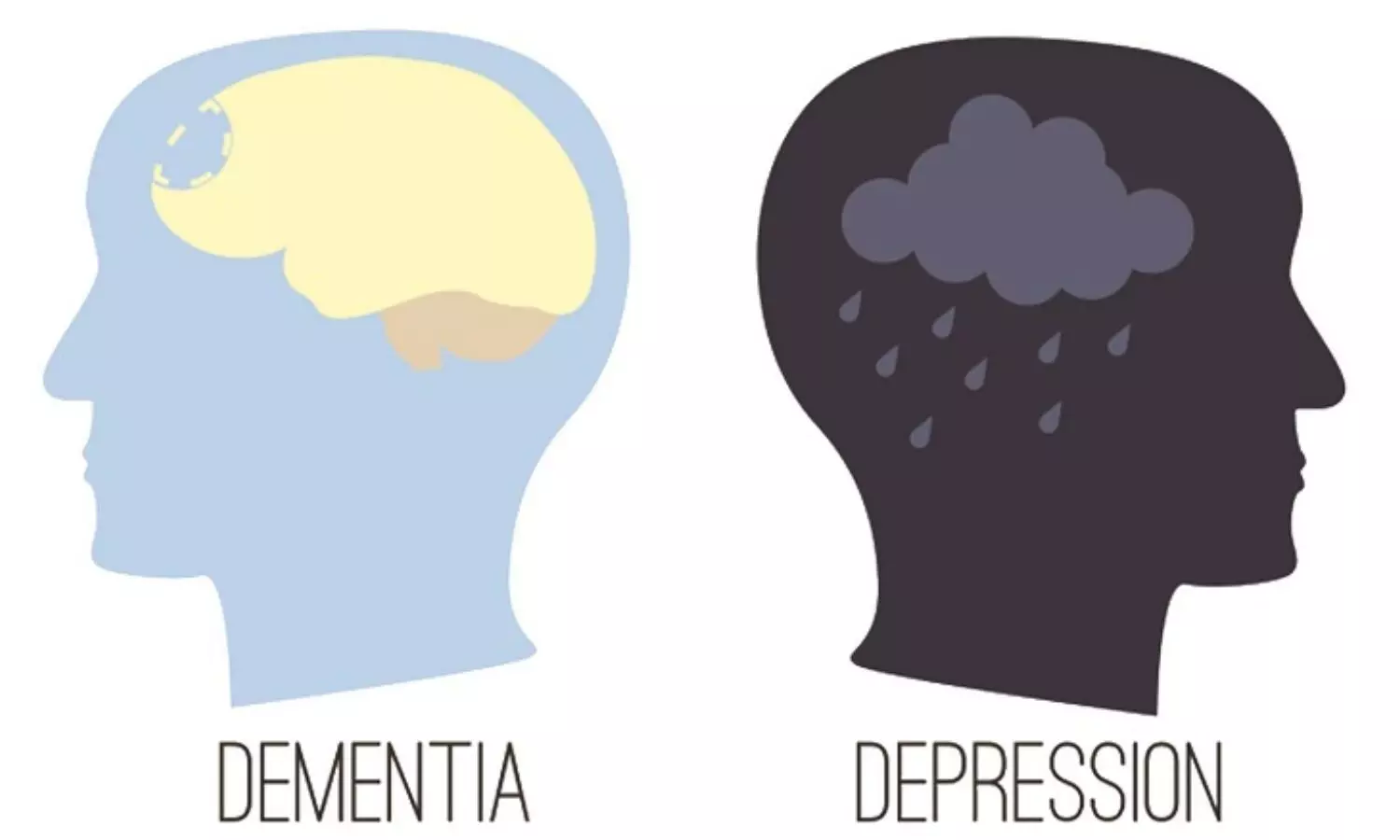 Dementia and Depression