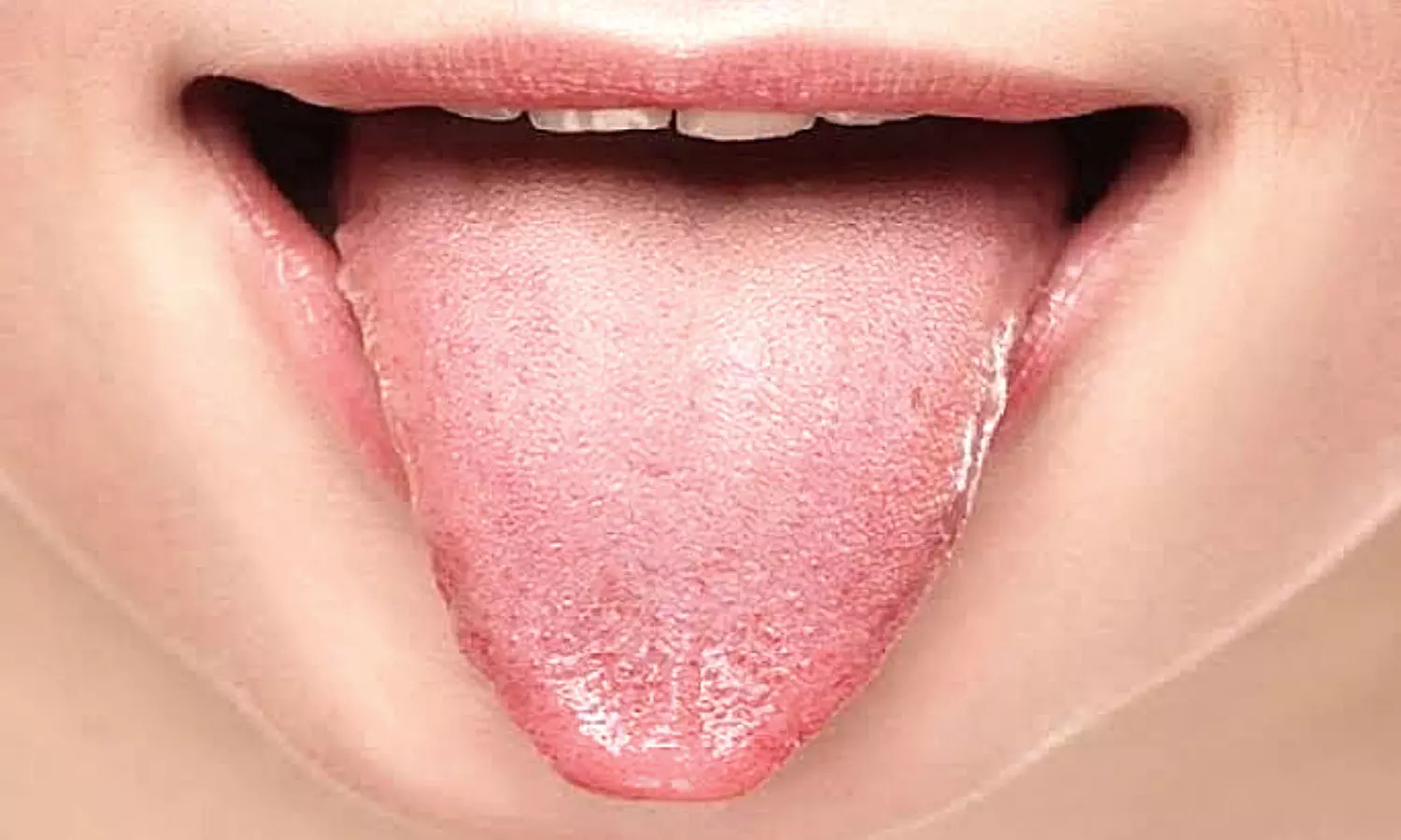 What your tongue Color says about your Health