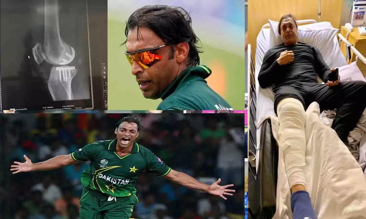 Shoaib Akhtar Surgery