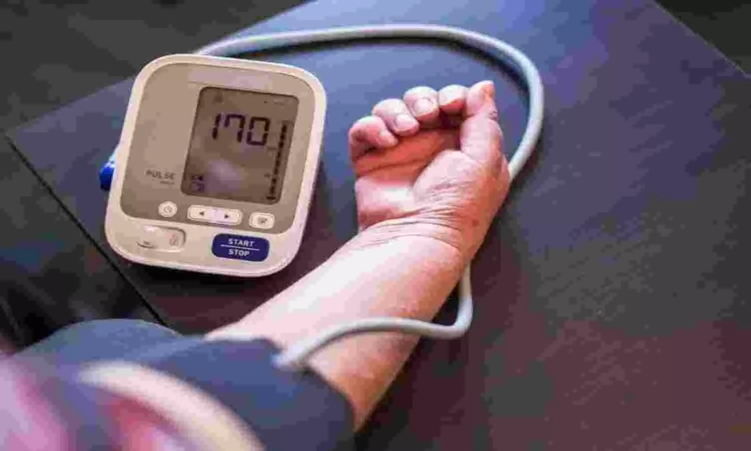 High Blood Pressure Signs