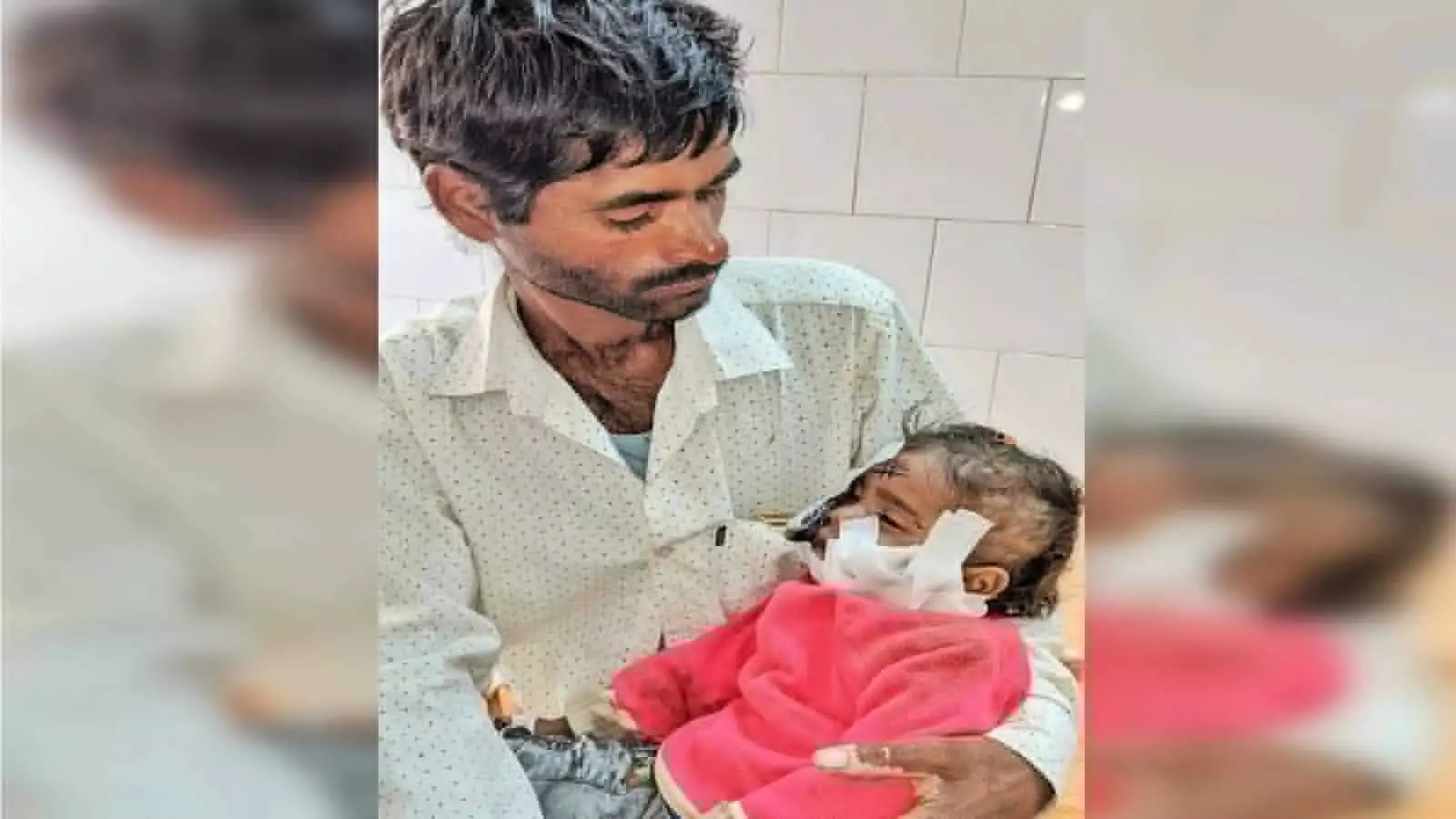 dog attack in vijay nagar ghaziabad one year old girl injured got 115 stitches