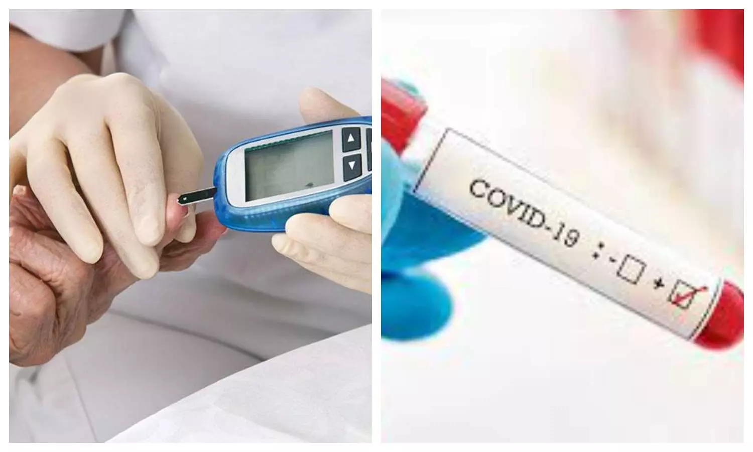 Covid Positive and Diabetes