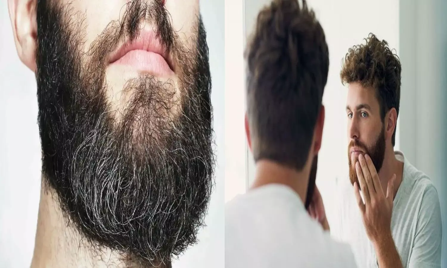 White Hair Beard Treatment