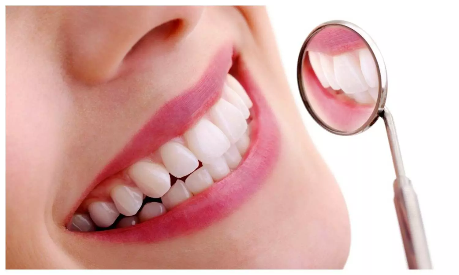 Teeth Whitening Tips in Hindi