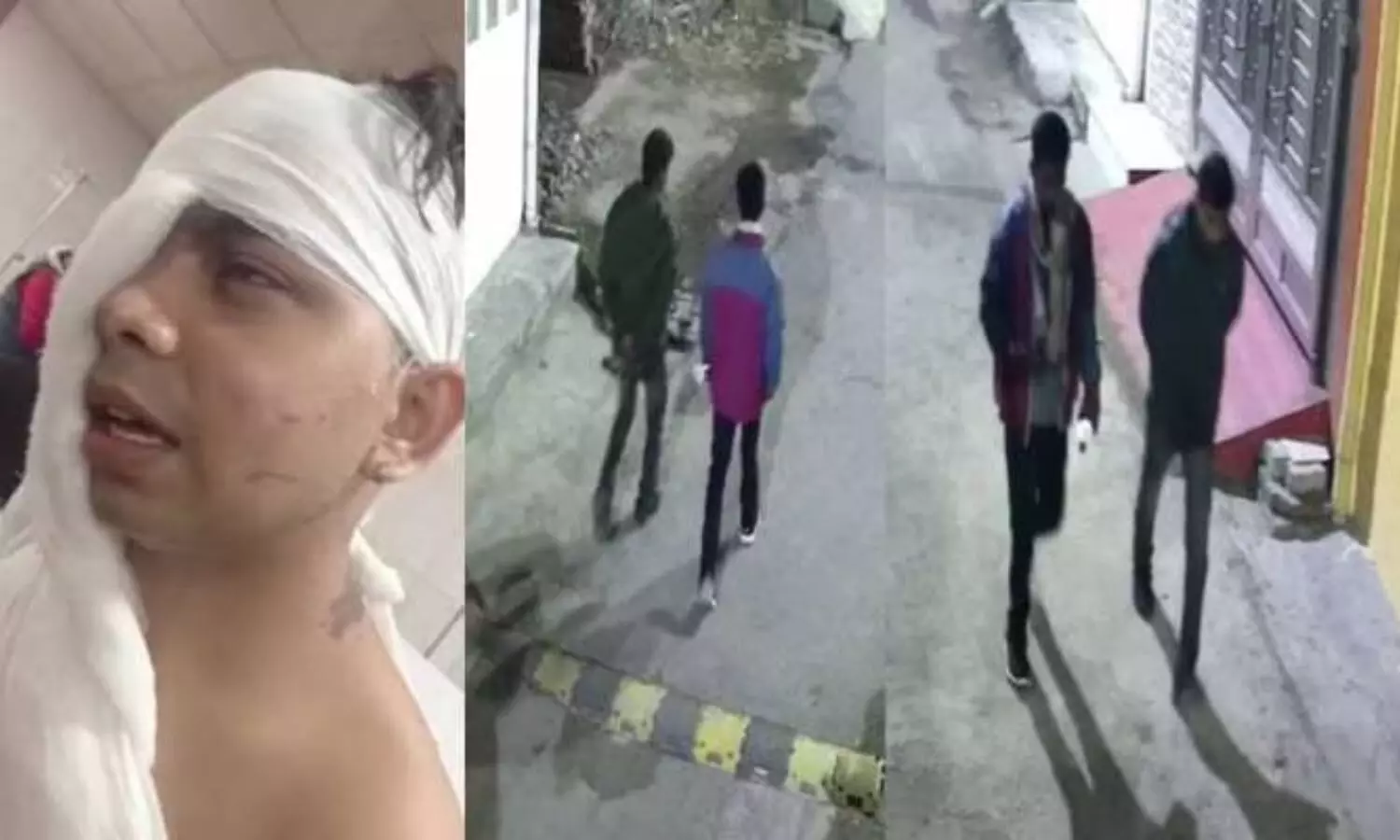 Lucknow Acid Attack: मां बेटे पर तेजाब फेंकने वाले दो आरोपी गिरफ्तार