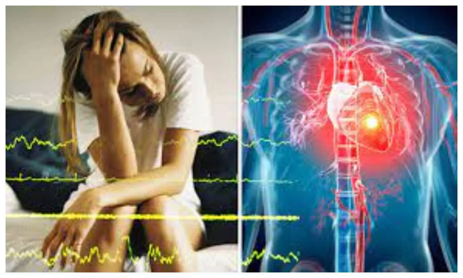 Lack Of Sleep Can Cause Heart Attack