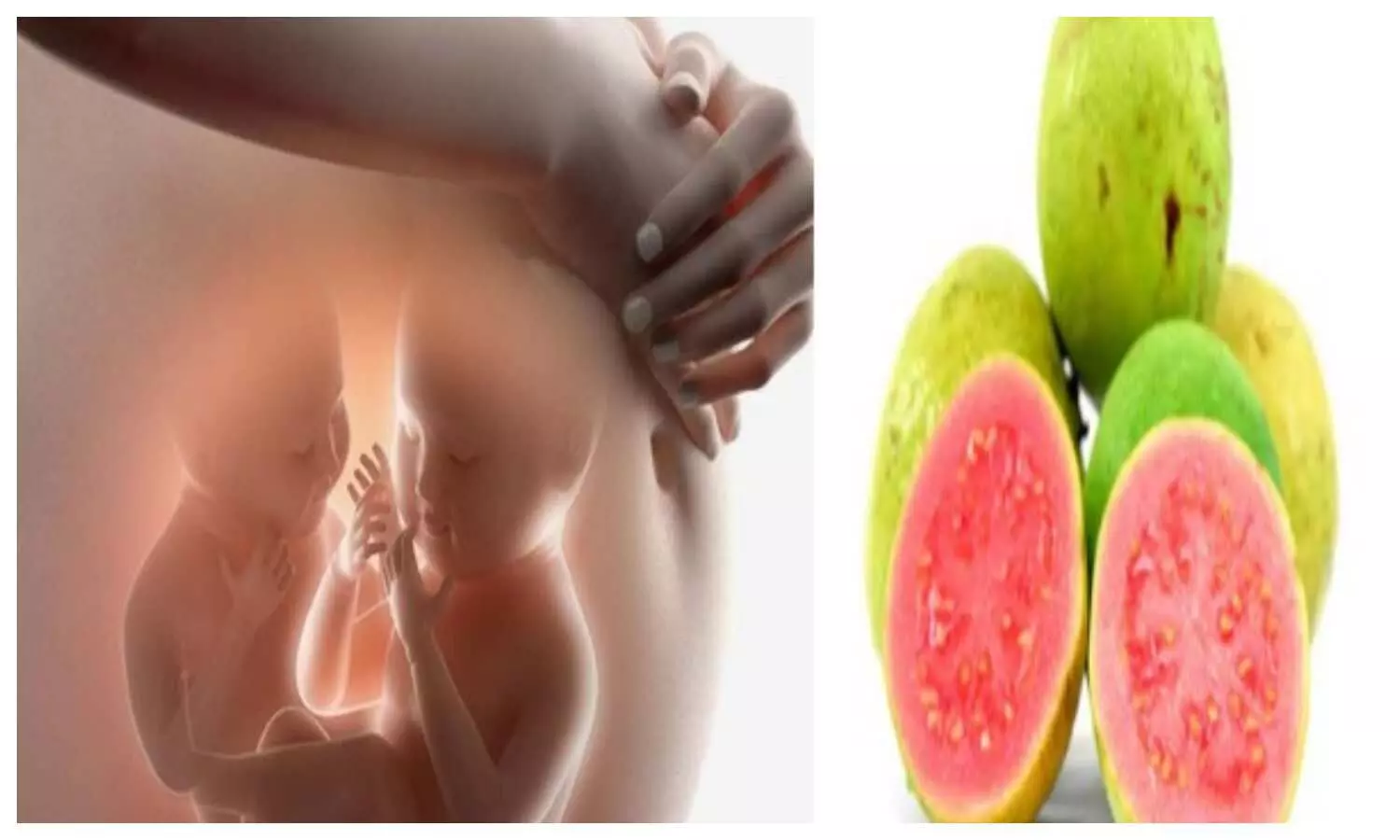 Guava During Pregnancy