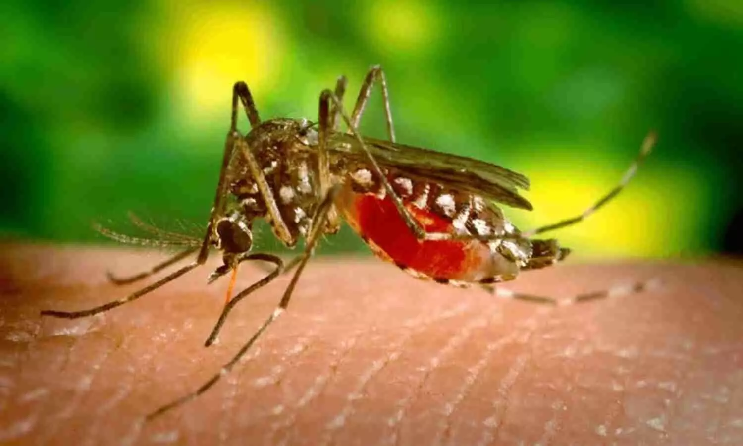 Lucknow  Dengue case