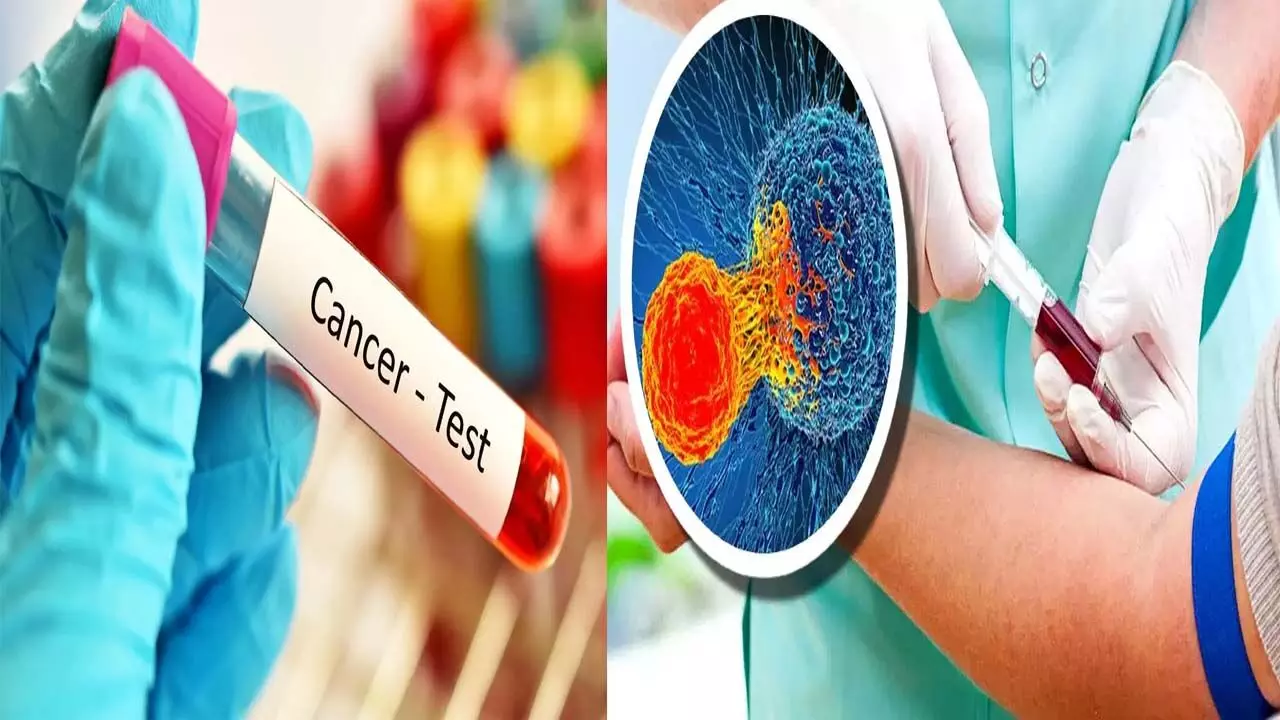 New discovery - a blood test that will detect cancer even before symptoms appear
