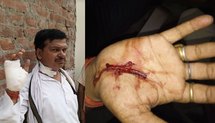 योगी राज में BJP नेता भी नहीं सुरक्षित घर में घुस चाक़ू से हमला