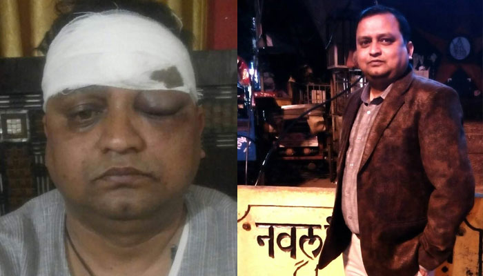 शर्मनाक: वरिष्ठ पत्रकार नवलकांत पर जानलेवा हमला करने वाले गिरफ्तार,पूछताछ जारी