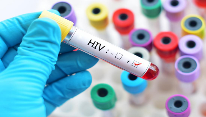रिपोर्ट: HIV संक्रमण से दिल के रोग का जोखिम दोगुना