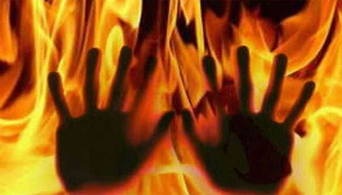 मचा हड़कंप: पत्नी के साथ जल गया आग में, आज छूट गया साथ