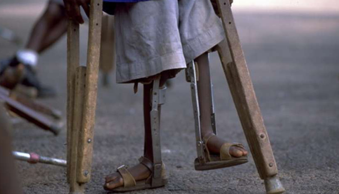 पाकिस्तान में पोलियो की मार झेल रहे बच्चे, 72 मामले आये सामने