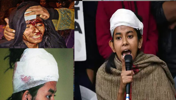 JNU हिंसा की खूनी तस्वीर: आखिर कौन हैं आईशी घोष, जो बनीं चर्चा का विषय
