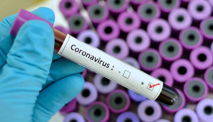 इन चिजों से रहे सावधान, नही तो आपको भी हो सकता है कोरोना वायरस