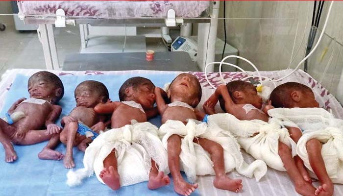 महिला ने दिया 6 बच्चों को जन्म, डिलीवरी कराने में डॉक्टरों के छूटे पसीने