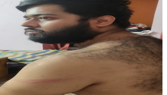 लॉकडाउन: भारतीय राष्ट्रीय छात्र संगठन के सचिव ने पुलिस पर लगाया पिटाई का आरोप