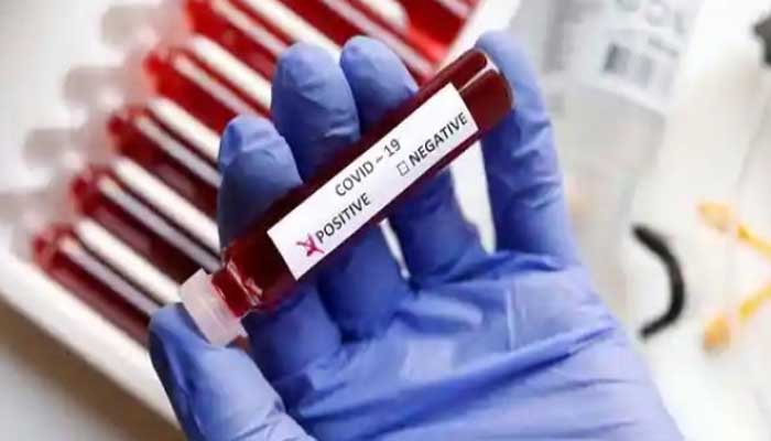 महामारी का प्रकोप: रायबरेली जिले में मिले 14 नए केस, इतनी हुई संक्रमितों की संख्या