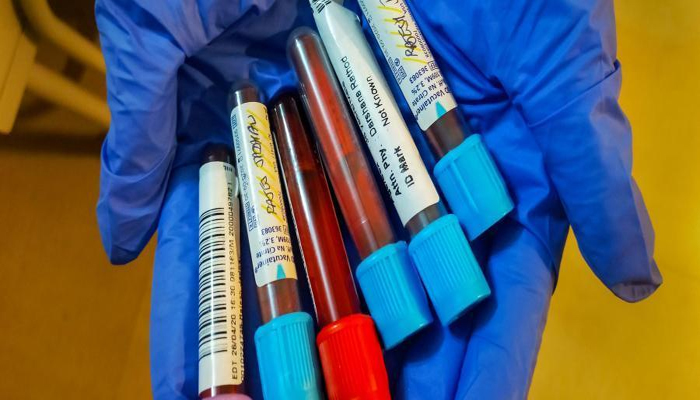 UP के इस जिले में कोरोना का कहर, नर्स समेत 19 नए संक्रमित मिले