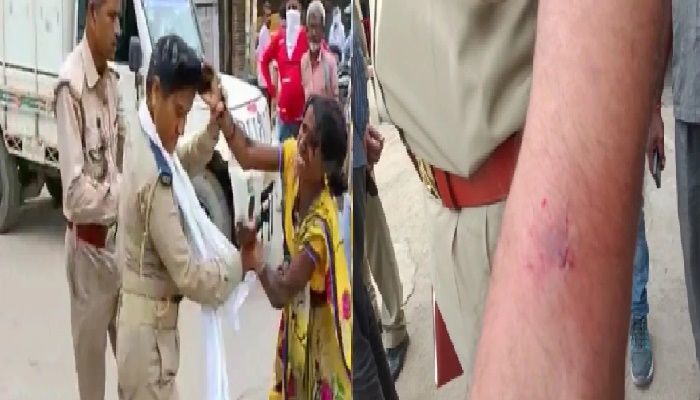 महिला ने काटा दरोगा के हाथ में, फिर पुलिसकर्मी से की मारपीट