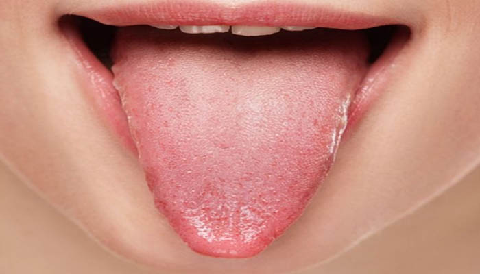 tounge2