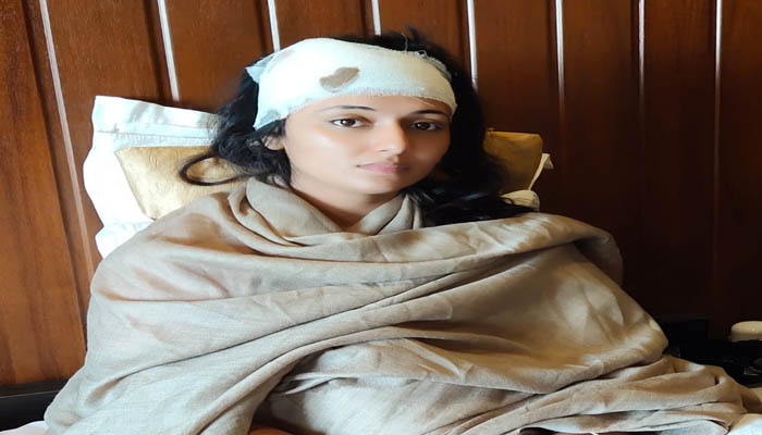 ताबड़तोड़ पत्थरबाजी फिल्म के सेट पर, जौनपुर में एक्ट्रेस हुई बुरी तरह घायल