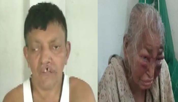 बंगाल में भाजपा कार्यकर्ता और उसकी मां पर जानलेवा हमला, टीएमसी पर लगा आरोप