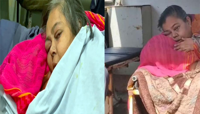 300 किलो की महिलाः सड़ने लगा शरीर, अस्पताल तक पहुंचने में हुई ये हालत